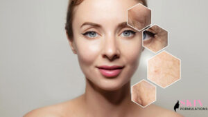skin aging
