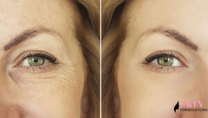 ways-to-Iron-out-wrinkles