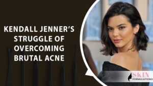 Kendall Jenners Struggle of Overcoming Brutal Acne