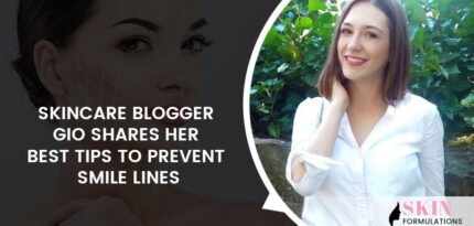 Prevent Smile Lines by Skincare Blogger Gio
