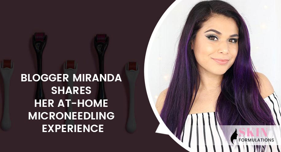 Microneedling by Beauty Blogger Miranda